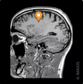<p>Name the major white matter tract, modality, and plane</p>