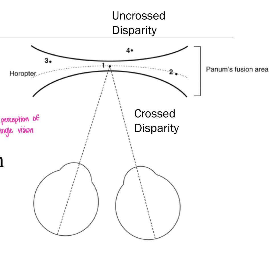 <ul><li><p>everywhere outside of the horopter has retinal disparity</p></li><li><p>in panum’s area, the disparity is small enough that you can percieve single vision (brain can solve correspondence problem)</p></li><li><p>disparity past that area creates <strong><u>diplopia</u></strong> (double vision)</p></li></ul><p></p>