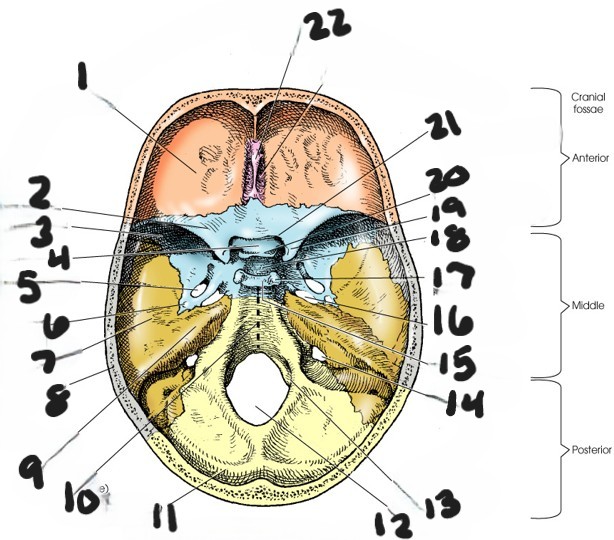 <p>what is #3?</p>