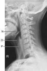 <p>What is letter N?</p>