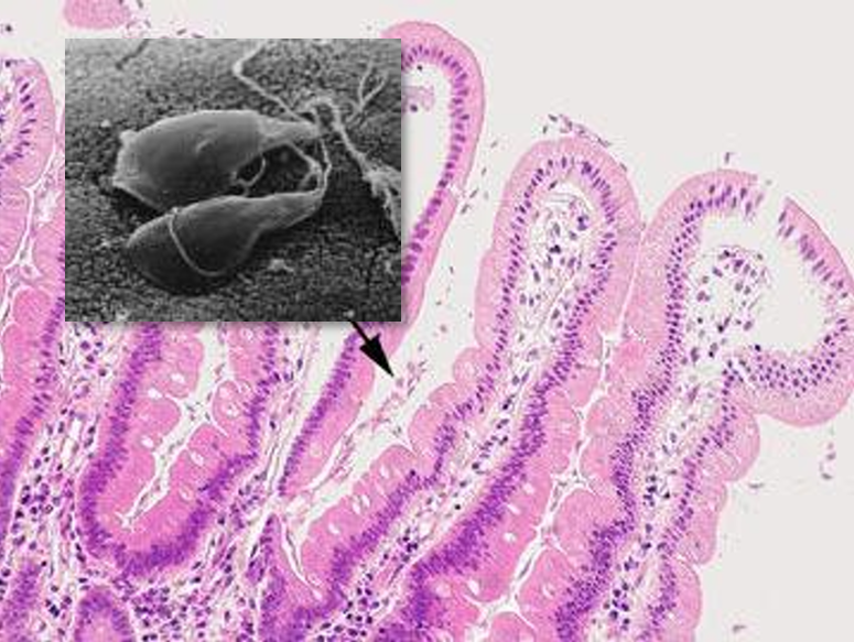 <p>lúmen do<strong> intestino delgado</strong></p>