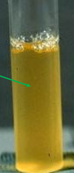 <p>test and result</p>
