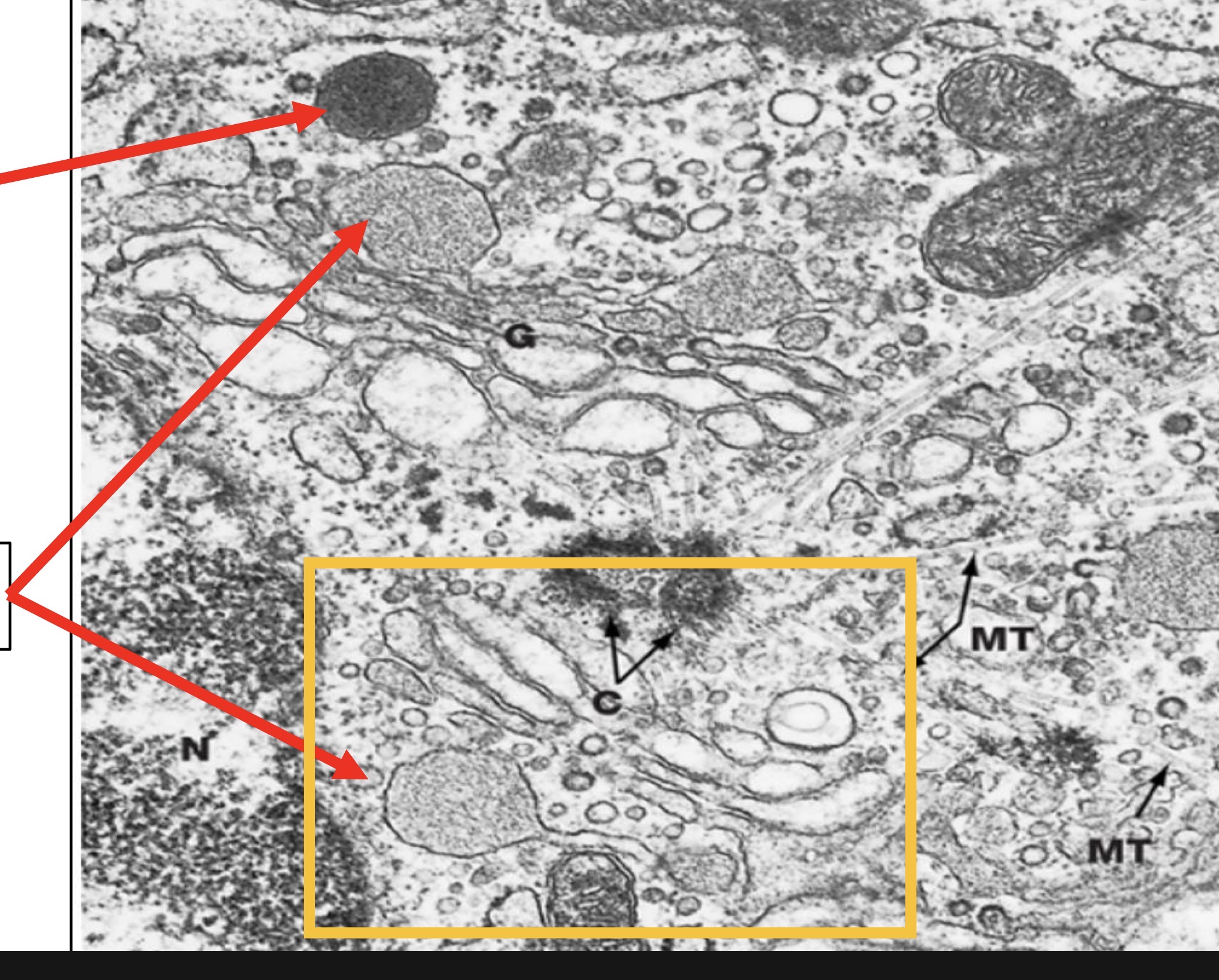 <p>(Golgi) What is the top arrow? What are the bottom arrows? </p>