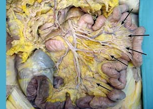 <p>what is the term for loops of arteries that supply the jejunum and ileum (as pictured here)</p>