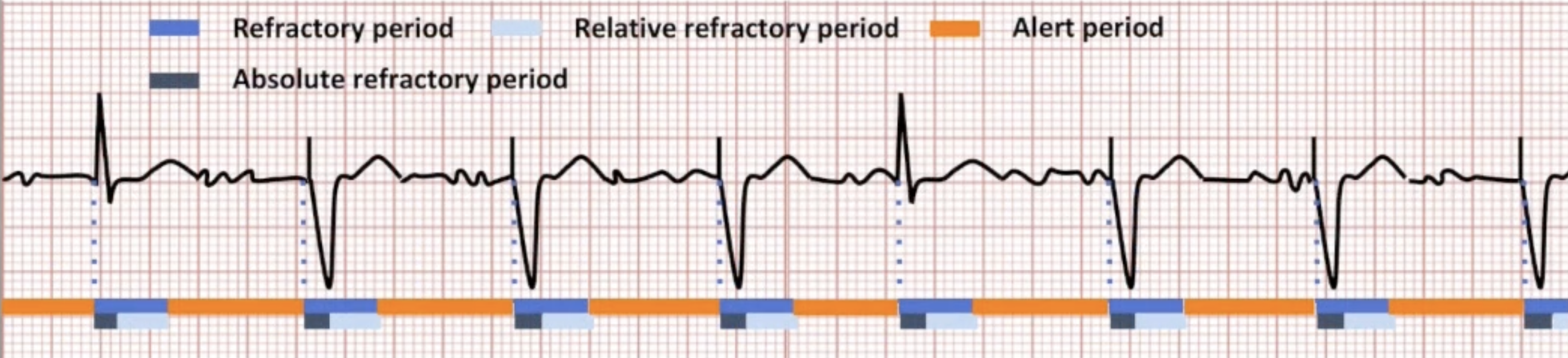 <ul><li><p>Prevents sensing of T waves and non-physiologic signals</p></li><li><p>Divided into absolute and relative refractory periods</p></li><li><p>End of refractory period triggers alert period</p></li><li><p>Fixed or dynamic</p></li></ul><p></p>