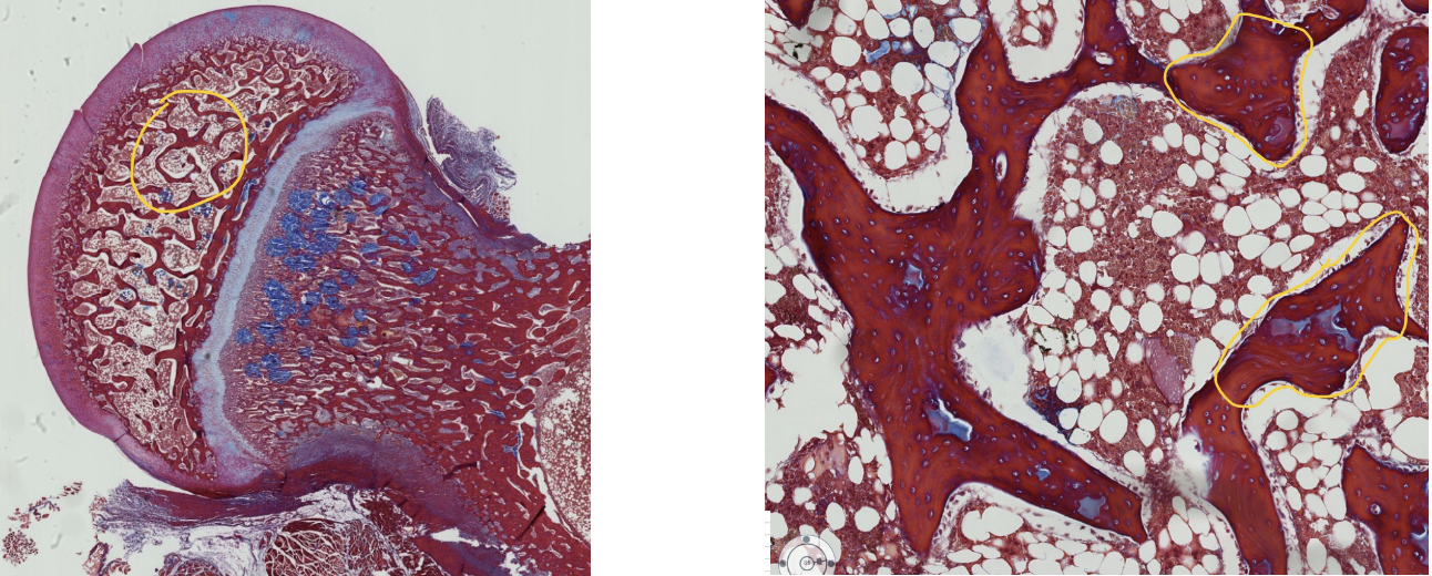 <p>A portion of the epiphysis is encircled in the left image and is enlarged in the right image.</p><p>What are the encircled spicules of bone called? (include all synonyms)</p>