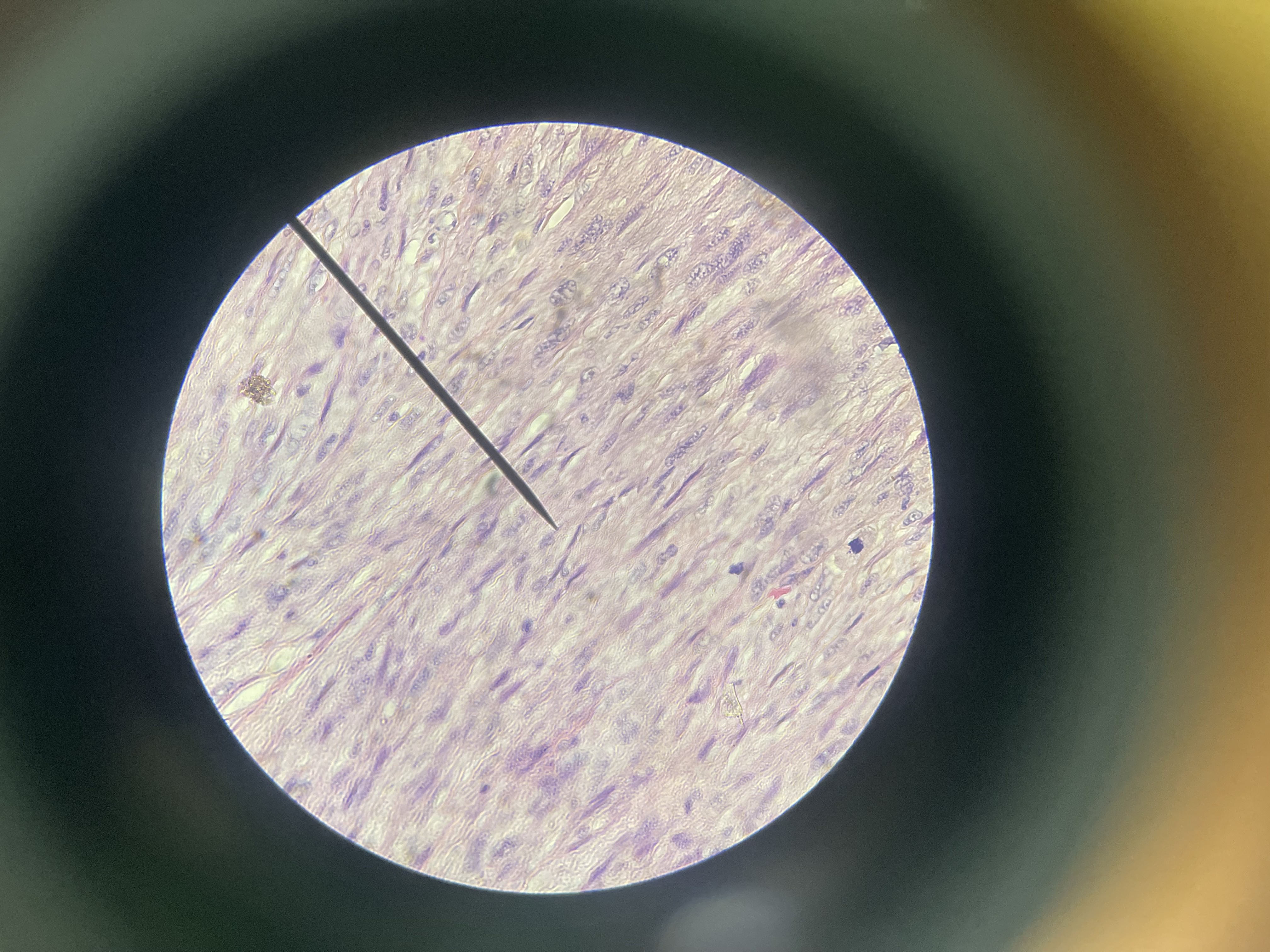 <p>What is the diagnosis?</p>