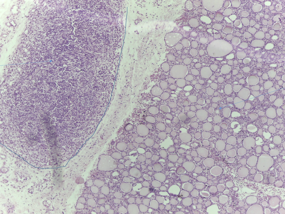 <p>What and where is the parathyroid?</p>