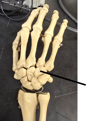 <p>Name Carpal Bone</p>