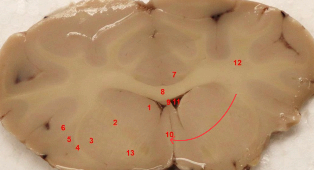 <p>what tract is this </p>