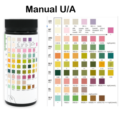 <p>Collecting urine:</p><p>General Collection (Clean Catch Mid-Stream)</p><p></p><p><strong>Male Anatomy</strong>: Wipe once, then perform a mid-stream catch.</p><p></p><p><strong>Female Anatomy</strong>: Wipe three times (right, left, middle) from front to back, then perform a mid-stream catch</p><p></p><p>Actual Procedure:</p><ul><li><p>Place a urine sample onto a blue chuck and remove the dipstick from the bottle.</p><p></p></li><li><p></p><p>Place dipstick into urine, submerge all the squares.</p><p></p></li><li><p></p><p>Slide strip off the side of the cup or pat one side on blue chuck pad once--to prevent the colors from running.</p><p></p></li><li><p></p><p>Wait for the squares to develop (time in seconds is listed next to each square on the bottle; the top leukocytes are finished after 120 sec).</p><p></p></li><li><p></p><p>Line up the stick with the container and record values, bottom up.</p></li></ul><p></p>