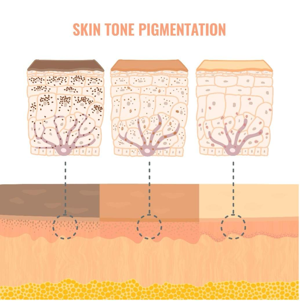 <p><strong>Carotene: </strong>Orange-yellow pigment that accumulates in the epidermis; derived from orange vegetables; converts to vitamin A, which aids in eye function.</p><p></p><p><strong>Melanin:</strong> Brown, yellow-brown, or black pigment produced by melanocytes within the stratum basale; packaged in melanosomes and transferred into keratinocytes.</p><p></p>