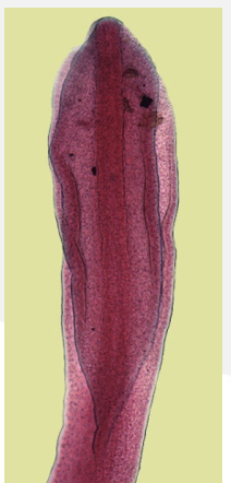 <p>What type of cestode is this?</p>