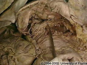 <p>what structure is pictured here (be specfic)?</p>