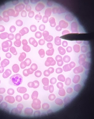 <p>The slide depicts which type of leukocytes</p>