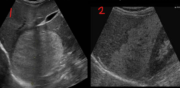 <p>Identify this image. </p>