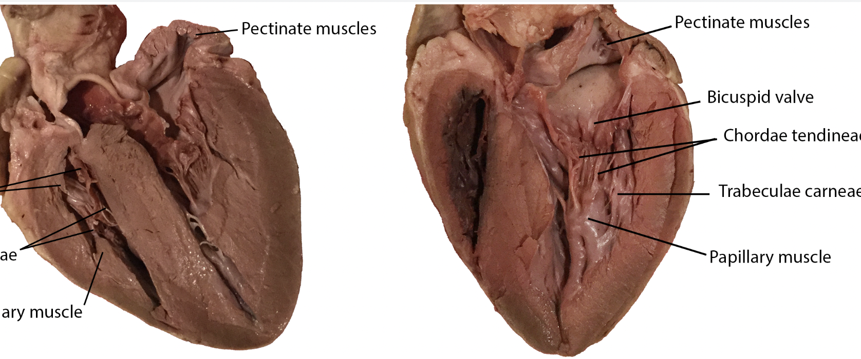 <p>Pectinate muscle</p>