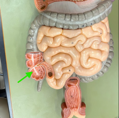 <p>What is the arrow pointing at?</p>