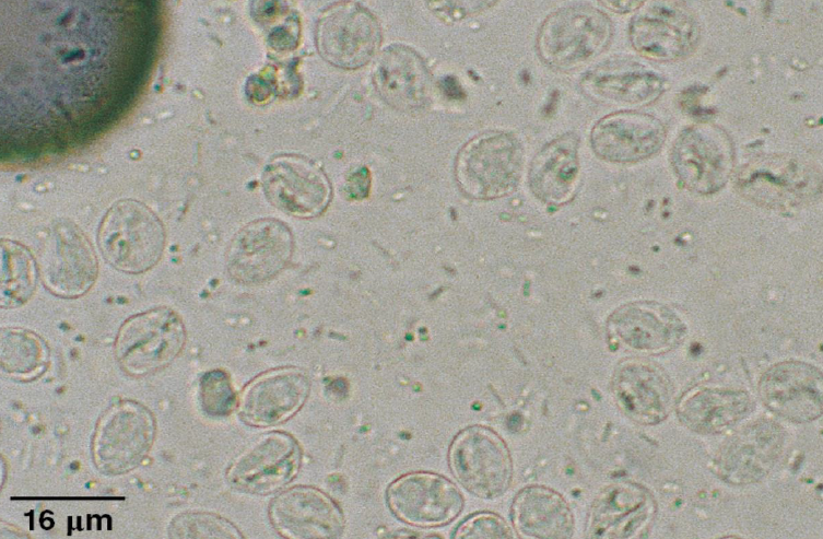 <p><em>Giardia:</em> Diagnosis</p>