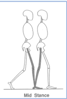 <p>12-30%</p><ul><li><p>First half of single-limb support.</p></li><li><p>Ends as weight aligns over the forefoot.</p></li><li><p>OBJECTIVES</p><ul><li><p>Progress over a stationary foot</p></li><li><p>Limb &amp; trunk stability</p></li></ul></li></ul><p></p>