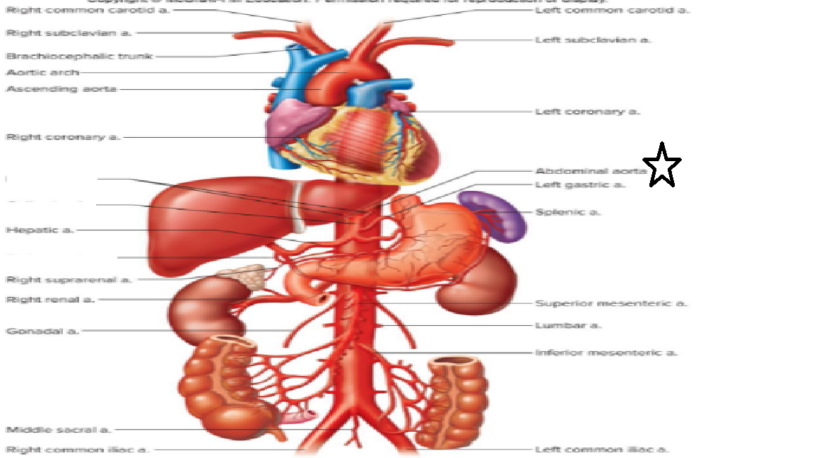 <p>Abdominal aorta.</p>