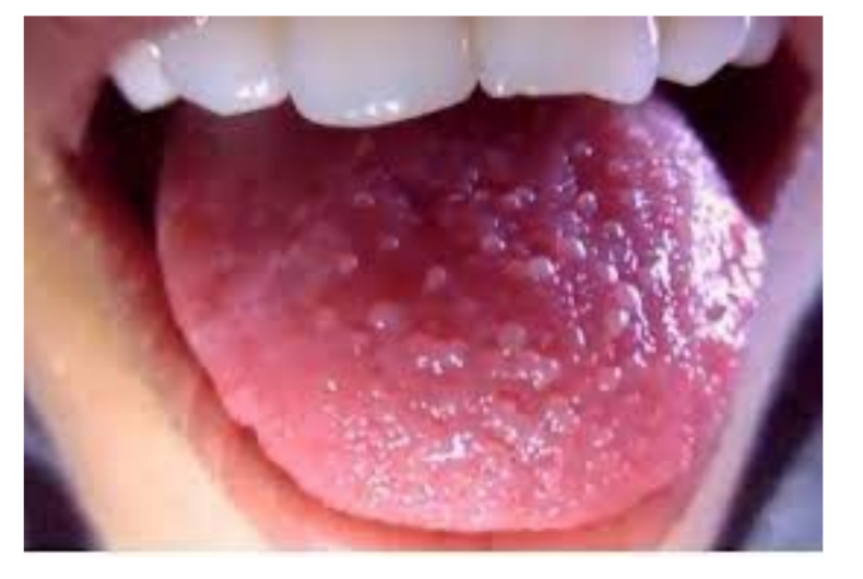 <ul><li><p>Does burning your tongue actually kill tastebuds?</p><ul><li><p>yes, but every 8-10 days, tastebuds are recreated through mitosisZ</p></li></ul></li></ul><p></p>