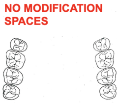 <p>What kennedy classification?</p>