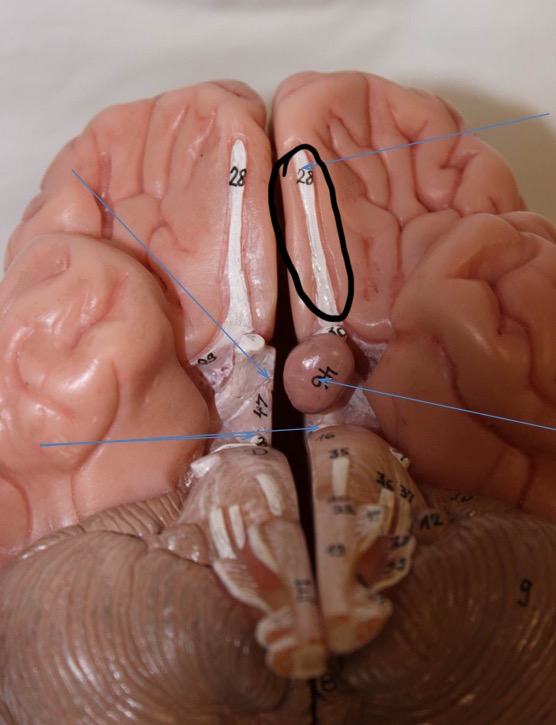 <p>Identify the circled area?</p>