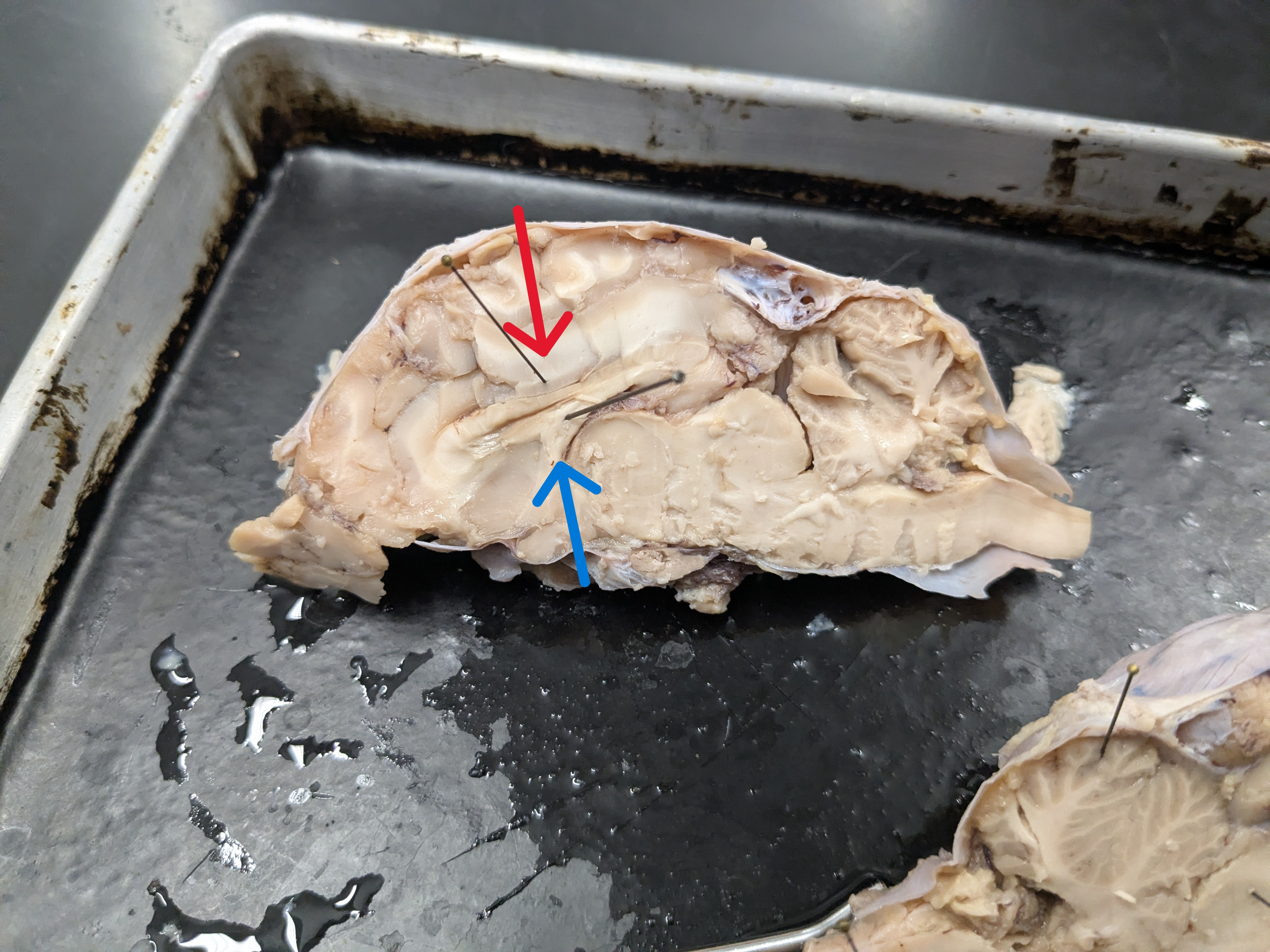 <p>red= corous callosum</p><p>blue= fornix</p>