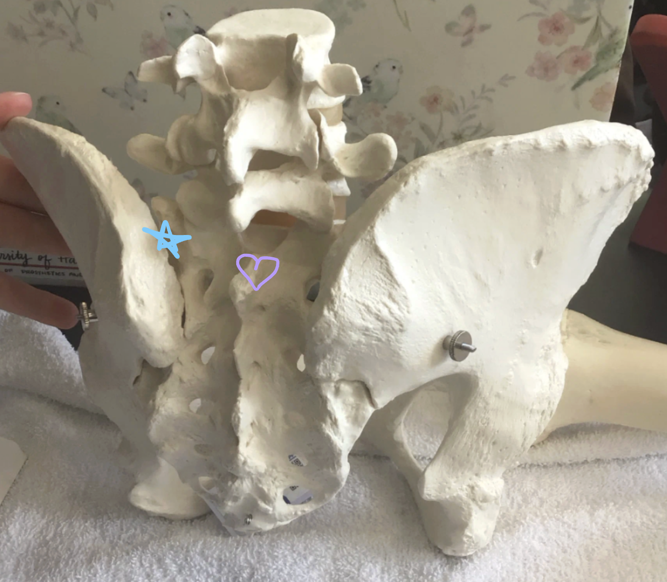 <p>Blue star: What is this structure? What joint forms here and what is its function?</p><p>Purple heart: What is this structure? Why is it important?</p>