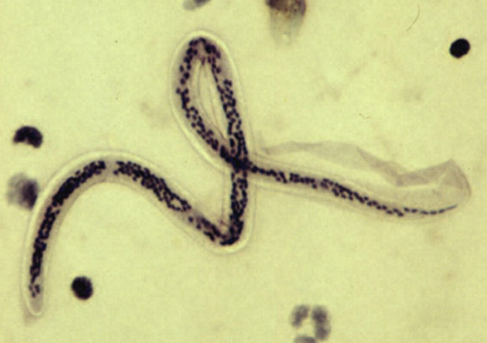 <p>What parasite is this?</p>