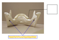 <p>Posterior View of Mandible</p>