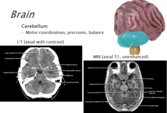 <p>the "little brain" at the rear of the brainstem; functions include processing sensory input and coordinating movement output and balance</p>
