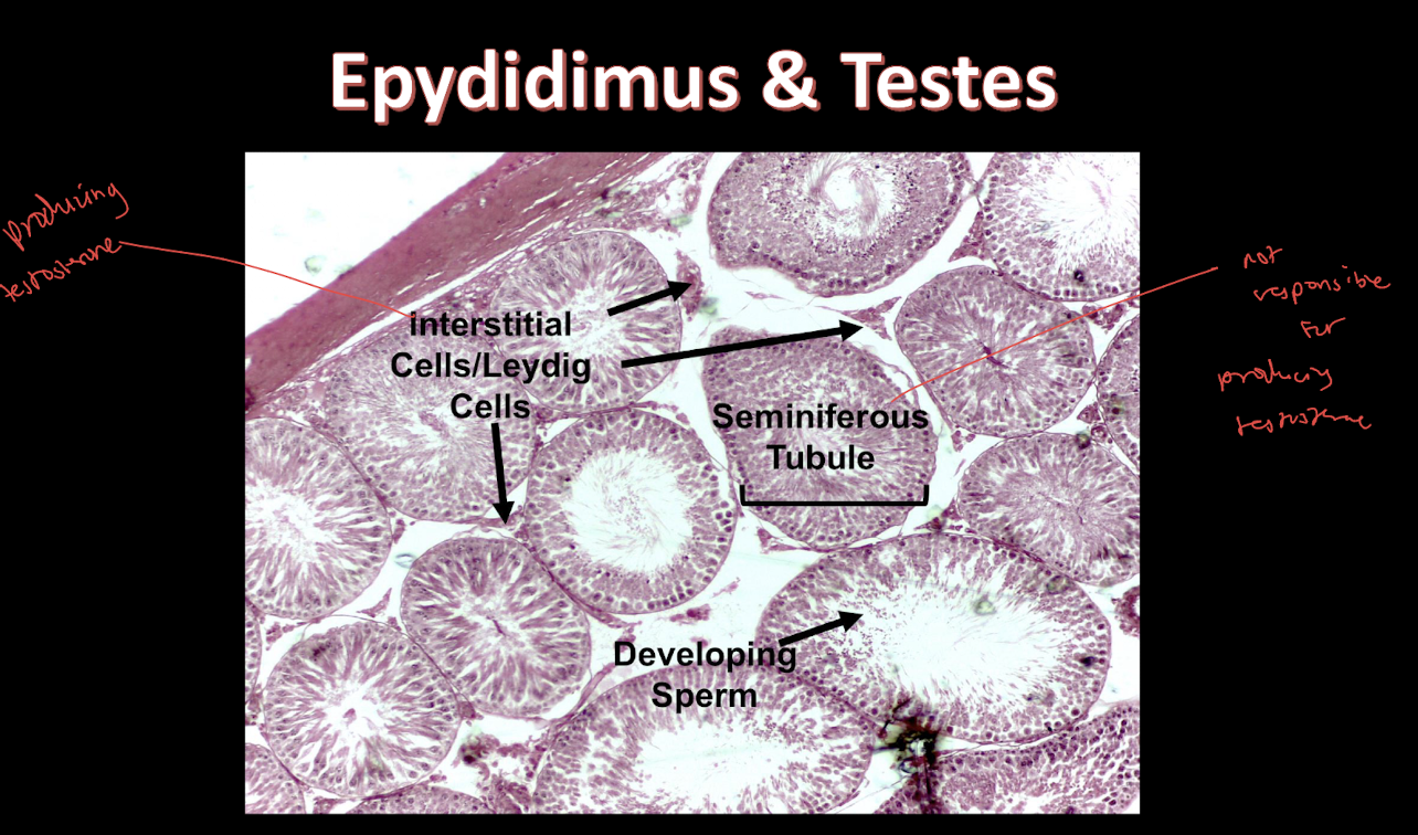 <p>Interstitial/Leydig Cells</p>