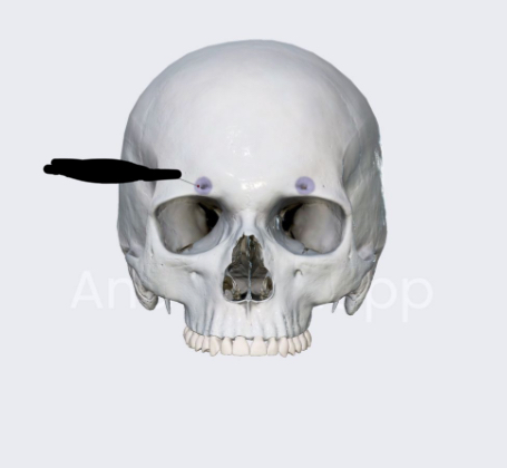 <p>What figure is highlighted in purple? Lesion to this would cause?</p>
