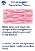 Dense connective tissue with collagen fibers running in many directions, allowing it to resist stress from multiple directions. Example: Scar tissue can contain dense irregular connective tissue.