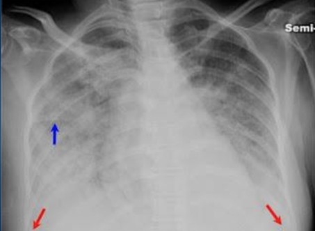 <p>opacities indicate</p>