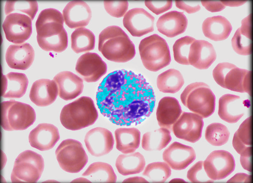 <p>Cytoplasmic Granules in Eosinophil</p>