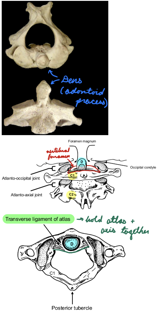 <p>Axial</p><p>Dens (Odontoid Process): Articulate with C1 (vertebral foramen)</p><p>Transverse Ligament: Around dens</p><ul><li><p>Hold atlas + axis together</p></li></ul><p></p>