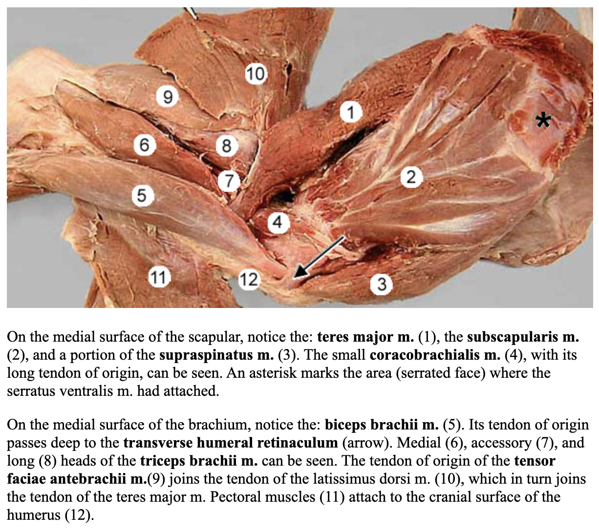 <p>attachments: subscapularis fossa of the scapula and lesser tubercle of the humerus</p><p>action: act as a shoulder stabilizer; adduct the limb at the shoulder joint</p><p>nerve: subscapular nerve </p><p>blood: subscapular artery </p>
