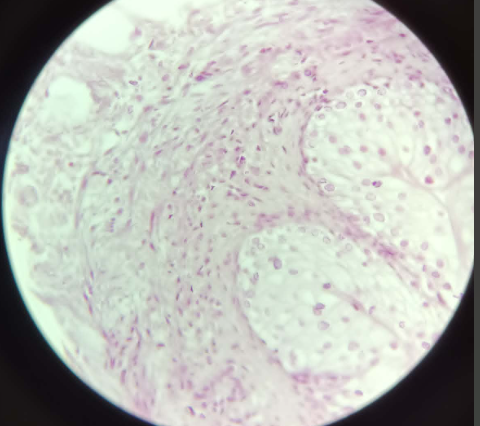 <p>Ureter Transitional Epithelium - HE (59)</p><ul><li><p>surrounded by a lot fat tissue (adipose tissue)</p></li></ul><ol><li><p>Tunica Mucosa<br>a. Lamina epithelialis <br>- (3 layers) (wrinkle) transitional epithelium of henle<br>- stratified epithelium, a lot of membrane (looks like stripes); <br>- very small cylindrical shaped cells (stratum basale)<br>- on top, polygonal cells (tennis rocket shaped)<br>- on top, only one cell (umbrella cells; may have 2 nucleus)<br>- outer membrane of the cells, invagination (wrinkling) of the membrane, linked together by uroplakins (proteins) (protects cells from toxicity)</p><p>b. Lamina Propria</p></li><li><p>Tunica Muscularis - 2/3 layers of cells</p></li><li><p>Tunica adventitia - has a lot of big blood vessels</p></li></ol><p></p>