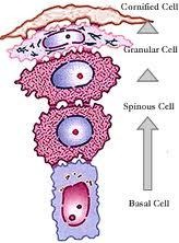 <p>Stratum corneum, stratum lucidum (thick skin only), stratum granulosum, stratum spinosum, and stratum basale.</p>