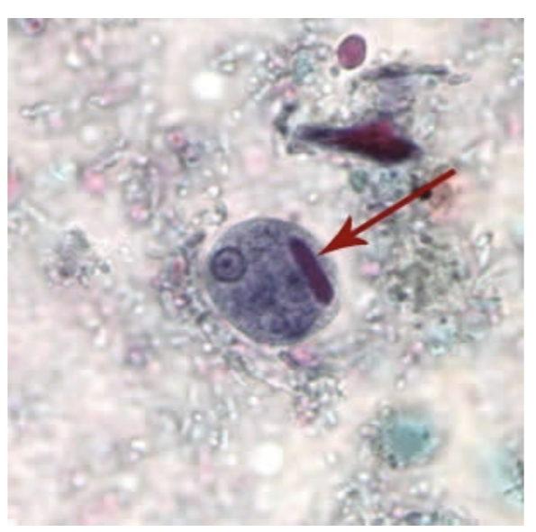 <p>-Up to 4 nuclei</p><p>-Chromatoida body with smooth ends</p>