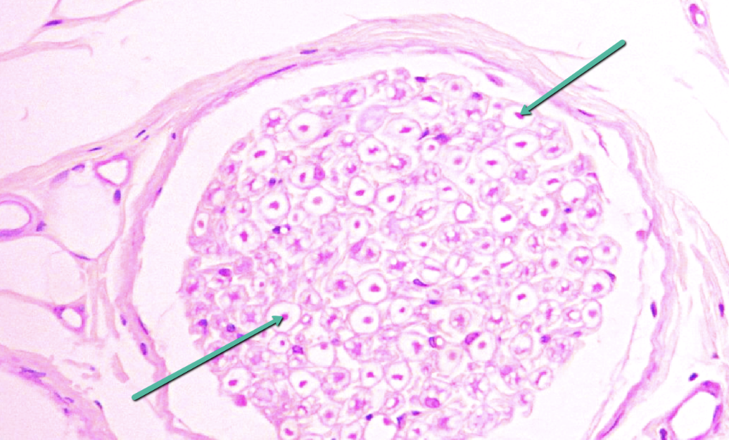 <p><span>Identify the small dark dots at the tip of the pointers.</span></p>