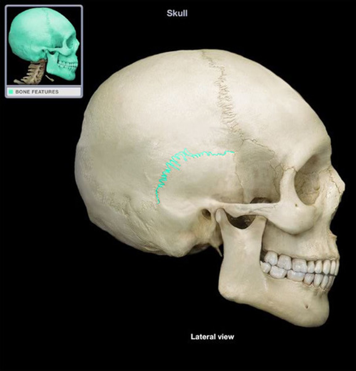 <p>Between parietal and temporal bones</p>