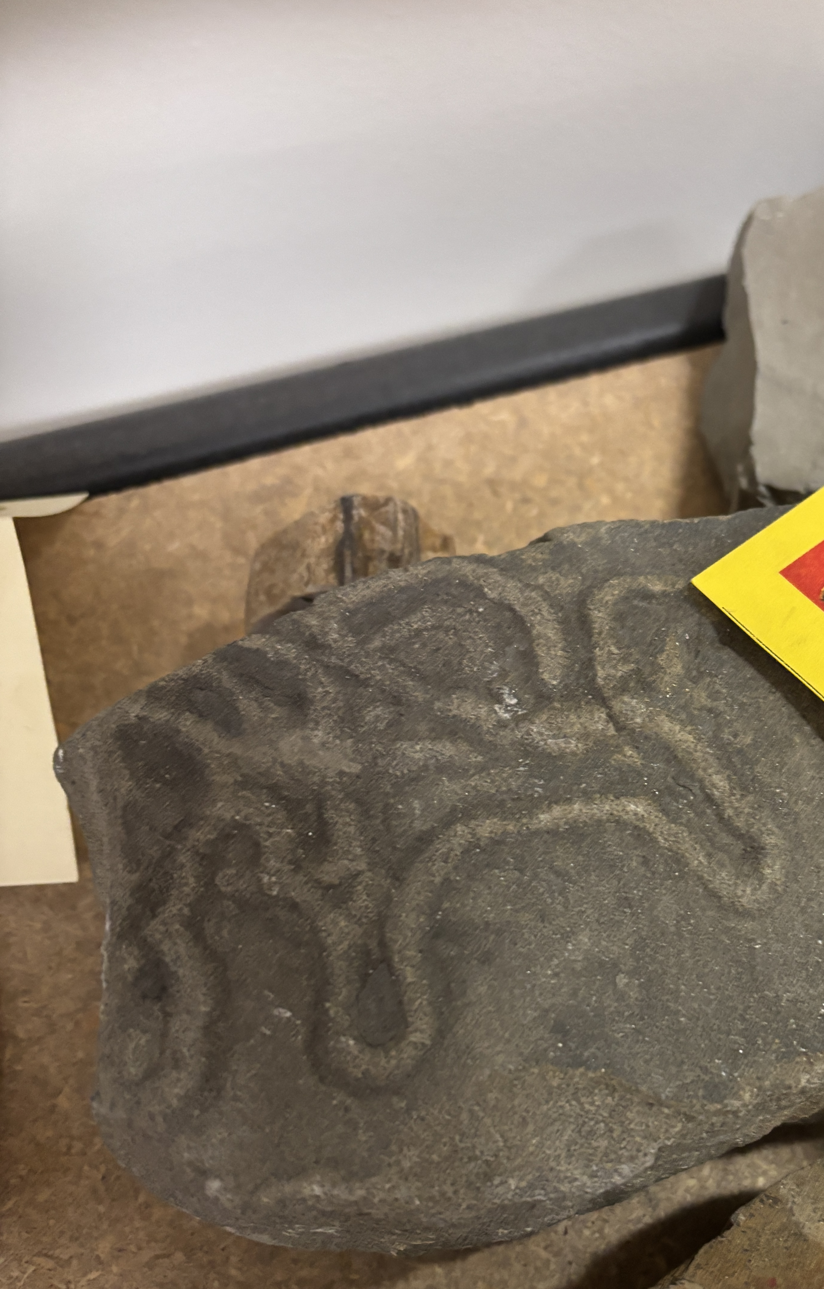 <p>squiggles, veins disease</p>