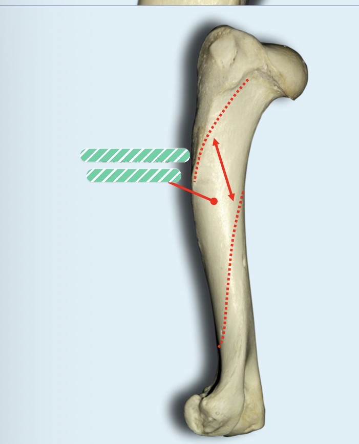 <p>Identify the structure</p>