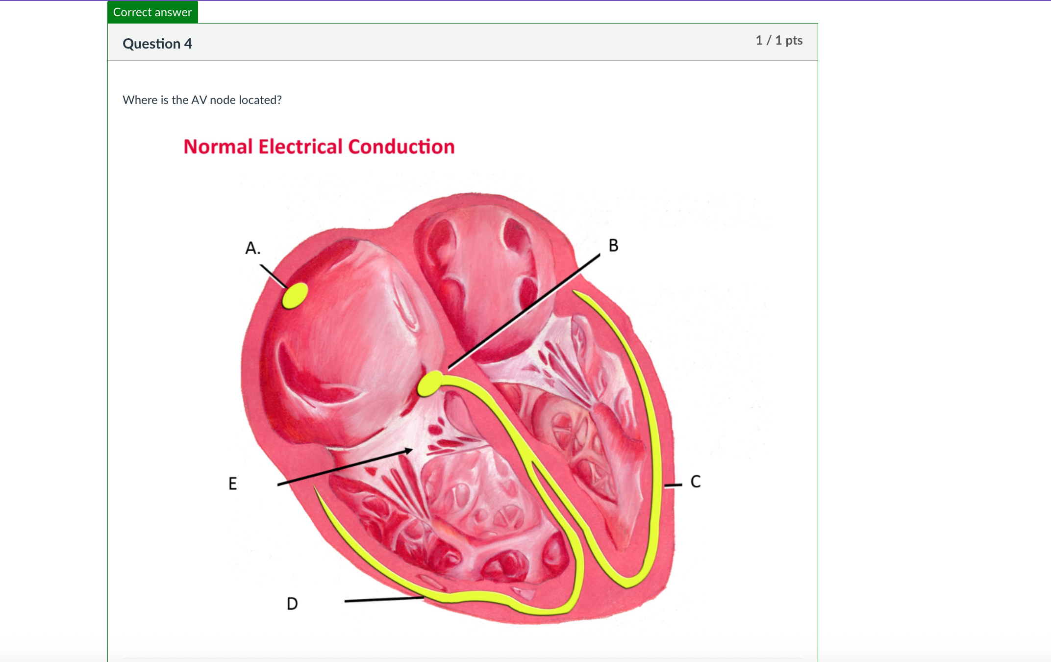 <p>Where is the AV node located?</p>