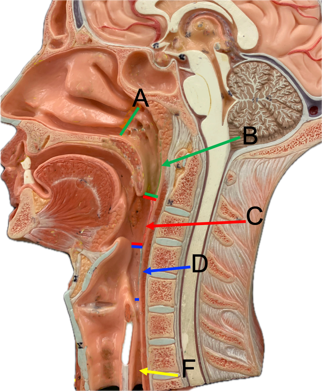 <p>F - made up of elastic cartilage</p>
