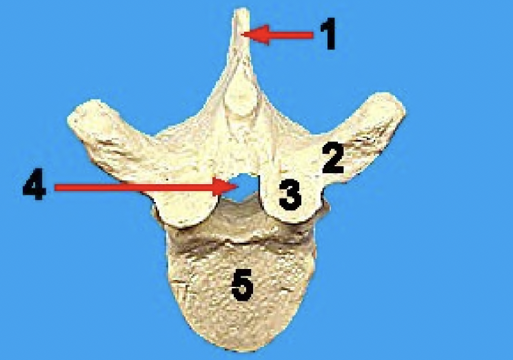 <p>what vertebra is this and what view</p>